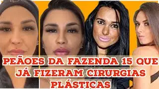 peãoes da fazenda 15 que já fizeram cirurgias plásticas (VEJA)
