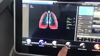Ventilación Mecánica Invasiva modo asistido controlado por volumen ciclado por tiempo