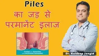 Piles (मस्से/बवासीर)  Permanent Solution | Piles Permanent treatment | Best Treatment of Piles