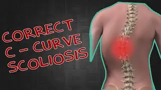 How to Correct a C-Shape Scoliosis: Kneeling