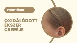 Oxidálódott migrén piercing cseréje