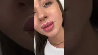 shape for 