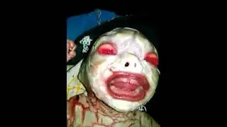 Weird, rare and Unknown disease of new born baby found in India