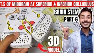 transverse section of midbrain at level of superior colliculus and inferior colliculus