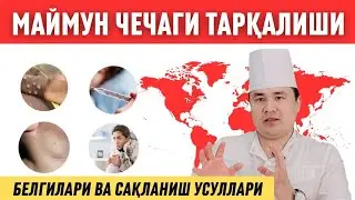 ДИҚҚАТ МАЙМУН ЧЕЧАГИ МАСАЛАСИДА АСОСИЙ МАЪЛУМОТЛАРНИ БИЛИБ ҚЎЙИНГ / ДОКТОР ИСЧАНОВ