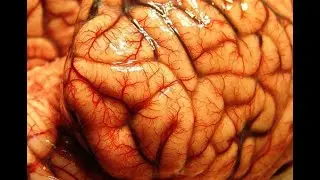 Telencephalon
