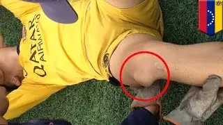 video menunjukkan cara membenarkan tempurung lutut yang copot - Tomonews