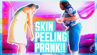 I TRIED THE SKIN PEELING PRANK ON MY MOM AND THIS HAPPENED...