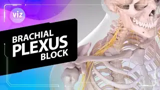 Brachial Plexus Block (3D Animation)