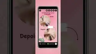 Divulgue seu serviço com um Story criativo do Instagram!