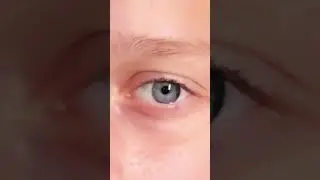 Оцените глаз