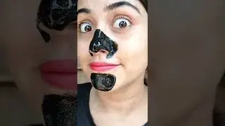 DIY Blackheads & Whiteheads at home 💯 | 