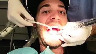 DRILLED IN THE FACE!! (10.24.13 - Day 1638)