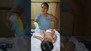 examen fisico del recien nacido y lactante menor