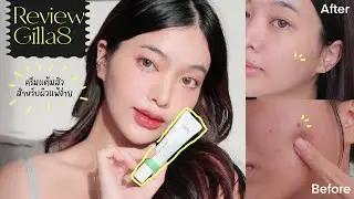 ครีมแต้มสิว Gilla8 จากเกาหลี ลดสิว ลดรอย ลองใช้จริง 1 อาทิตย์ ผิวดีขึ้น? ปังจริงมั้ย? | mildnitha