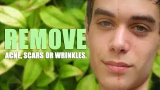 Remove Acne, Scars, or Wrinkles in Photoshop CC