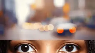 Causes of Blurred Vision
