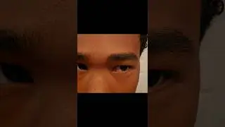 I looked at the solar eclipse and this happened #solar #solareclipse #solareclipse2024 #space