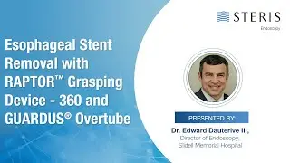 Esophageal Stent Removal with RAPTOR™ Grasping Device – 360 Rat-Tooth Forceps & GUARDUS® Overtube