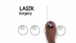 MN EYE   What is LASIK