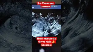 3-4 Хафталик хомила 😍😍