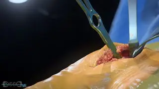 Osso VR | Shoulder Anatomy