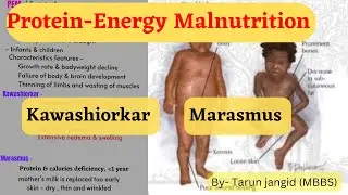 Kawashiorkar and Marasmus | PEM | Digestion and Absorption | NCERT short notes