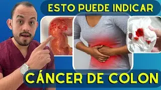 ⚠️ 6 𝗦𝗜𝗡𝗧𝗢𝗠𝗔𝗦 SILENCIOSOS del Cáncer de Colon y Recto. Detéctalo a Tiempo!