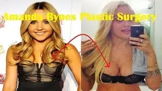Amanda Bynes Plastic Surgery Before and After