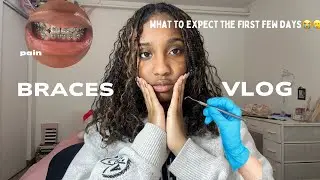 I GOT BRACES !! | my experience + what to expect | *very painful * 