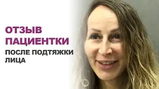Подтяжка лица и шеи в 54 года | Отзыв пациентки