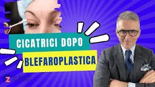 Cura delle Cicatrici nella prima settimana dopo una Blefaroplastica