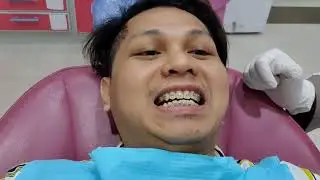 PROCESS GETTING BRACES |ADJUSTMENT |PART 2