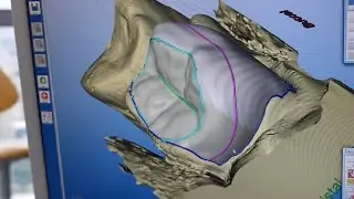 How Does the CAD CAM Work?