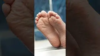 ¿Por qué los dedos se arrugan en el agua?
