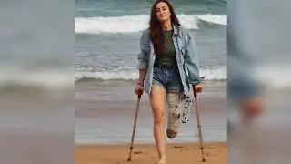 Amputee Women & the Art of Living Unbothered  | They Stare. She Keeps Moving. Disability - Devotees
