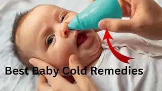 Top 5 Best Baby Cold Remedies 2024