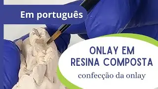 Onlay em resina composta - parte 4: confecção da onlay.