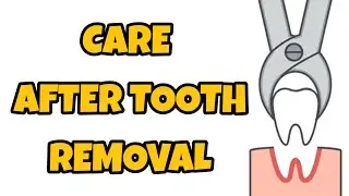 Care After Tooth Removal | DentEasy