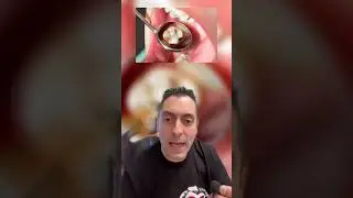 QUESTA RAGAZZA NON SI LAVA I DENTI DA 10 ANNI, COME SONO I SUOI DENTI ADESSO? INCREDIBILE SCOPRIRE..