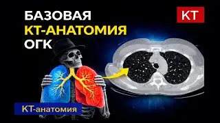 КТ органов грудной клетки: базовая анатомия врачу любой специальности