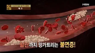 겨울잠이 보약! 불면증 극복해 혈관 건강 지키는 비법 [천기누설]