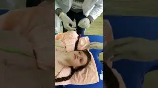Имплантации коллагеновых нитей.
Доктор Фан г. Пекин.