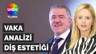 VAKA ANALİZİ: DİŞ ESTETİĞİ | GÜLÜŞ TASARIMI | SHOWTURK, EYLEM AKSIN & M.SC.DT ZAFER KAZAK