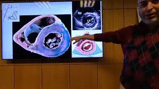 Echo Correlation with Surgical Anatomy (En) - Hatem Hosny