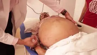 Know More About The Liver - Largest Organ In The Human Body
