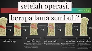 berapa lama setelah operasi bisa sembuh dan naik motor?