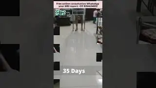 Fast Recovery after 