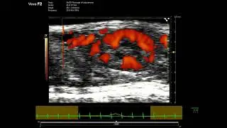 Mouse Kidney Vasculature