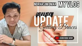 VLOG MY UPDATE GETTING BRACES